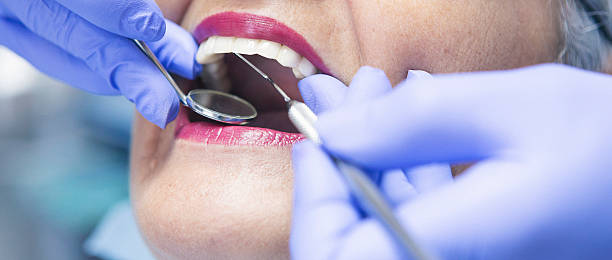 Emergency Dental Filling Replacement in AL